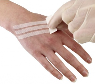 Полоски пластырные Leukostrip (Лейкострип) гипоаллергенная для закрытия и фиксации краев раны, стерильная, 6.4х76мм фото 4101