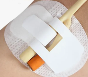 Фиксатор (повязка) для трубок, канюль, катетера Фолея фото 6136